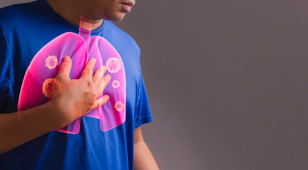 Akciğer Kanseri: Sinsi İlerliyor, Ama Önlemek Elimizde!